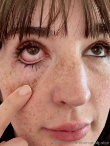 Halp i got the cums in my eye