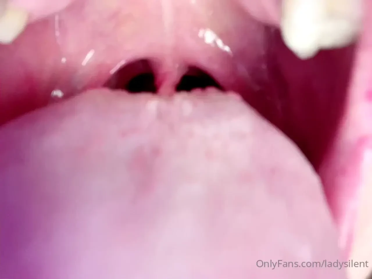 Uvula you want post more like this 