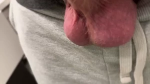 Veins for days part 2