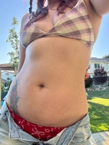 Most days i get uncomfortable with my scars but today i m reminded of