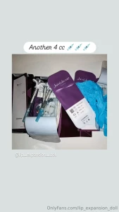 Good news my doctor pump 4 cc in my lips soon i do new content