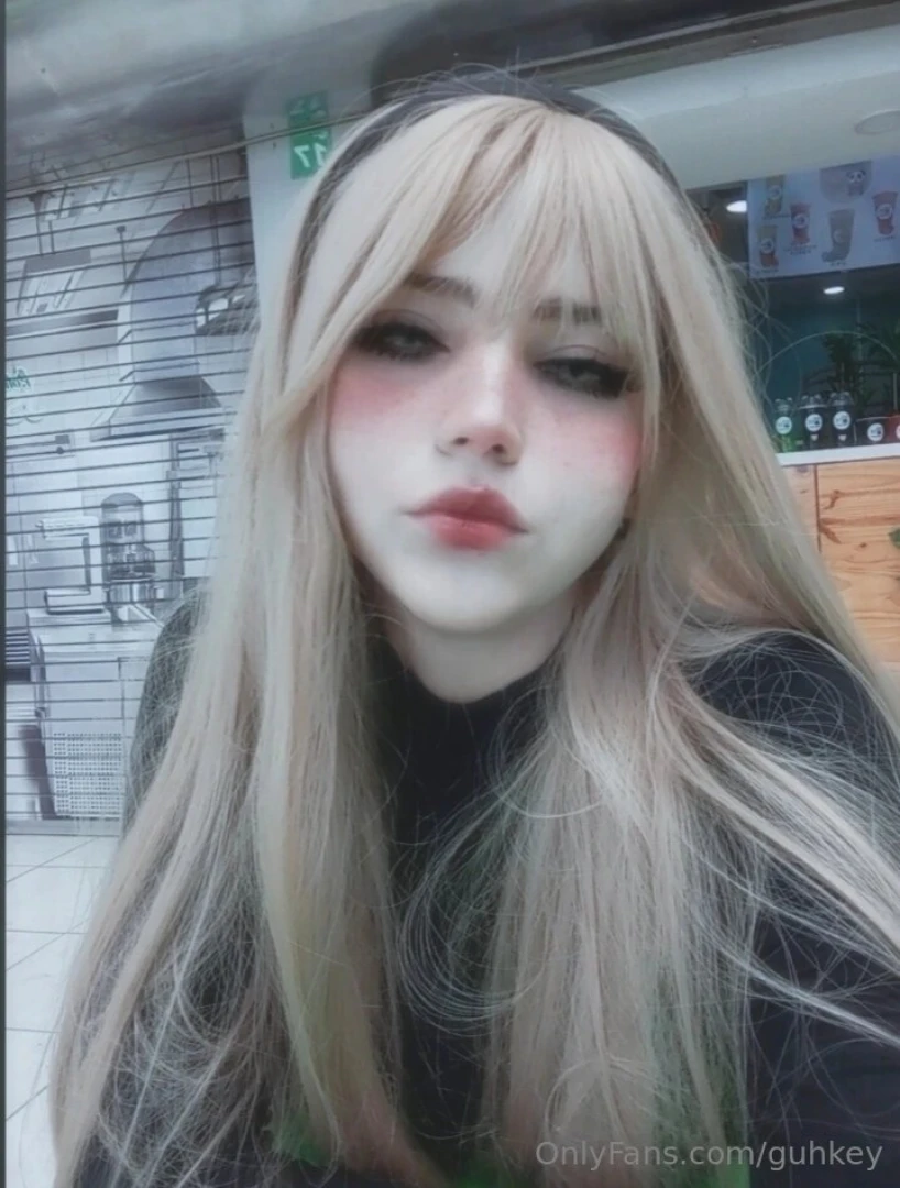Este fue mi d a sali a postoperatorios en san jos yyyy fue bastante part 2 