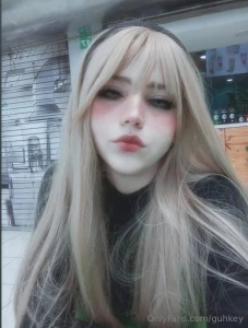 Este fue mi d a sali a postoperatorios en san jos yyyy fue bastante part 2
