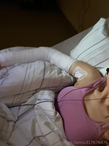 L ngere pause aber alles gut gegangen longer break but everything went