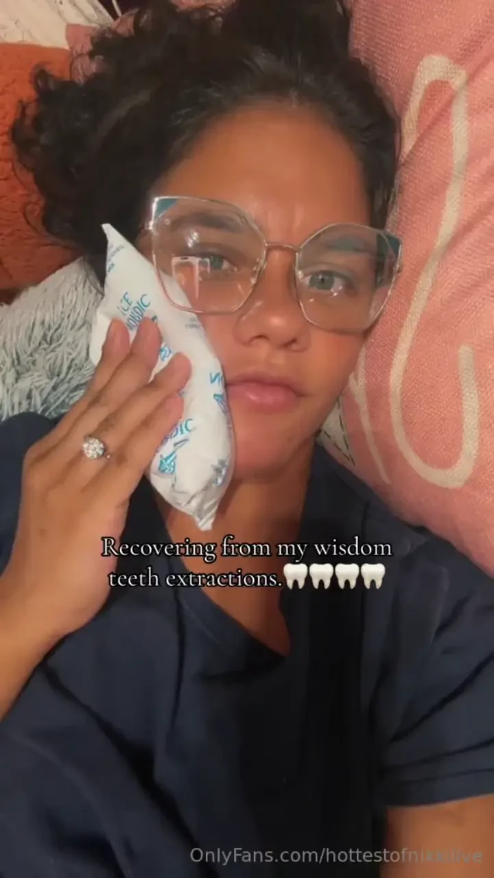 Happy monday guys i finally did it and got my wisdom teeth taken out 