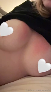 In need of a volunteer to rub aloe on my sunburnt tits part 2
