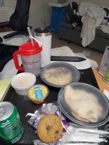 Had a couple small complications after surgery going to be stuck in