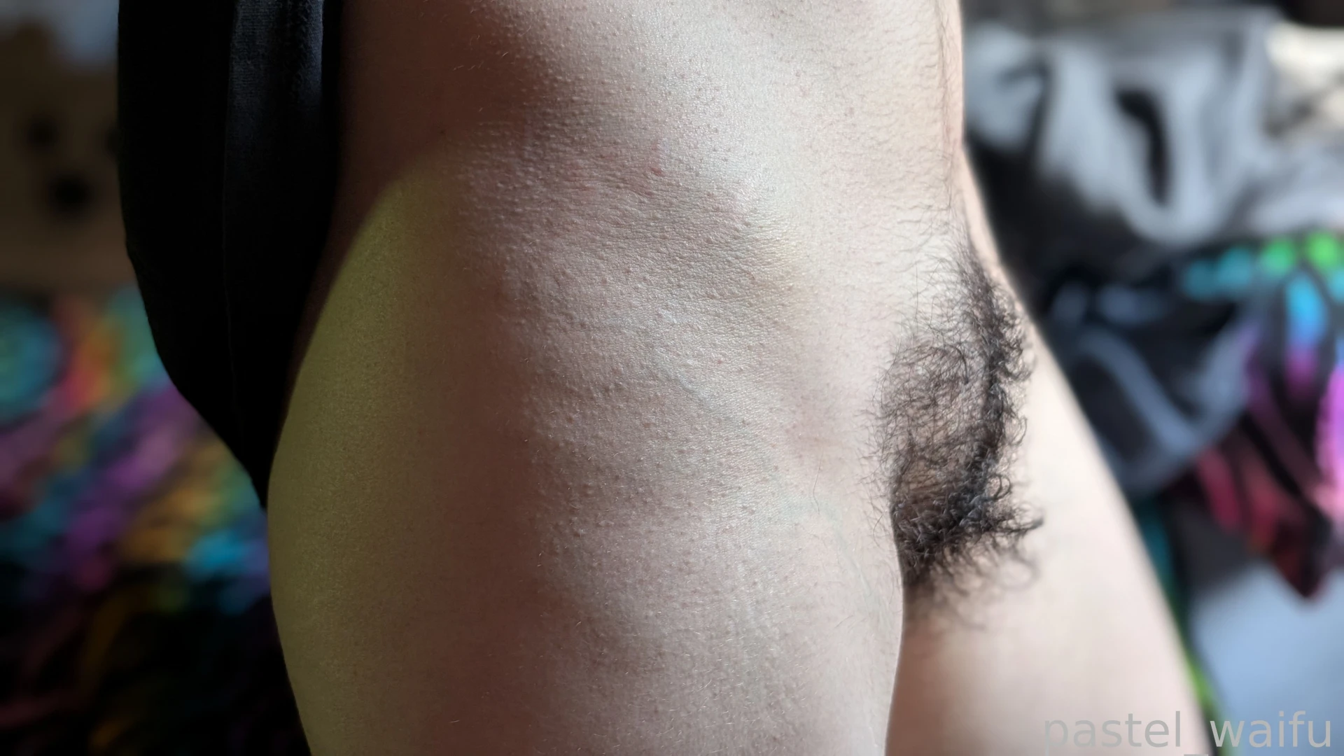 Hellooo one week post op im so happy to have this control over my body part 2 