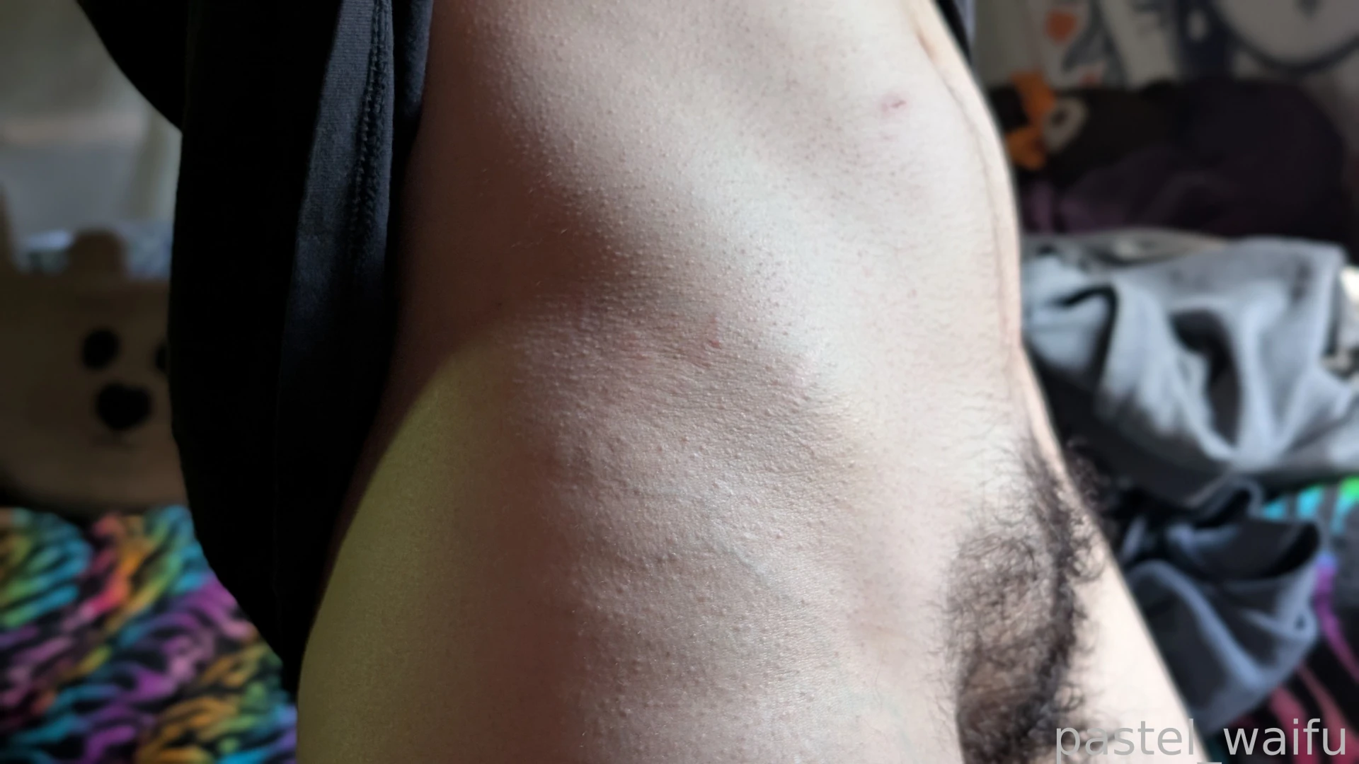 Hellooo one week post op im so happy to have this control over my body 