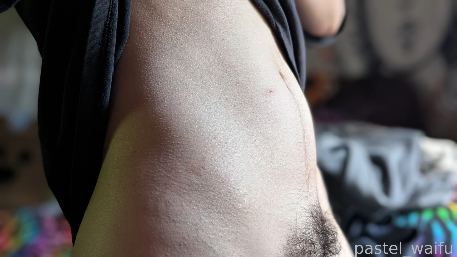 Hellooo one week post op im so happy to have this control over my body part 1 