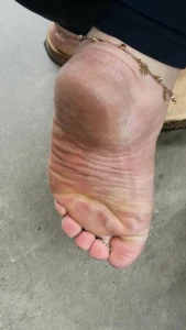 Little tease outside the car in my birks part 5