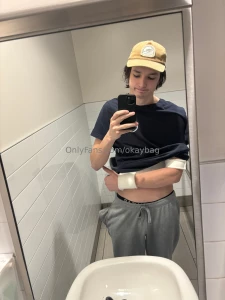 Guess who s back back again to the er arm got worse