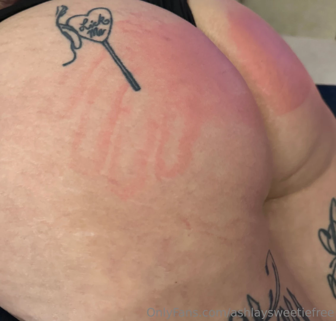 Will u kiss it and make it feel better 