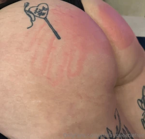 Will u kiss it and make it feel better