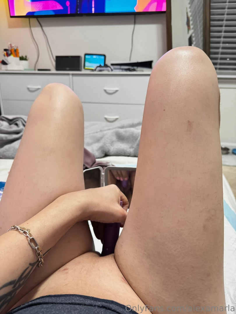 Dilation 8 weeks after surgery part 1 