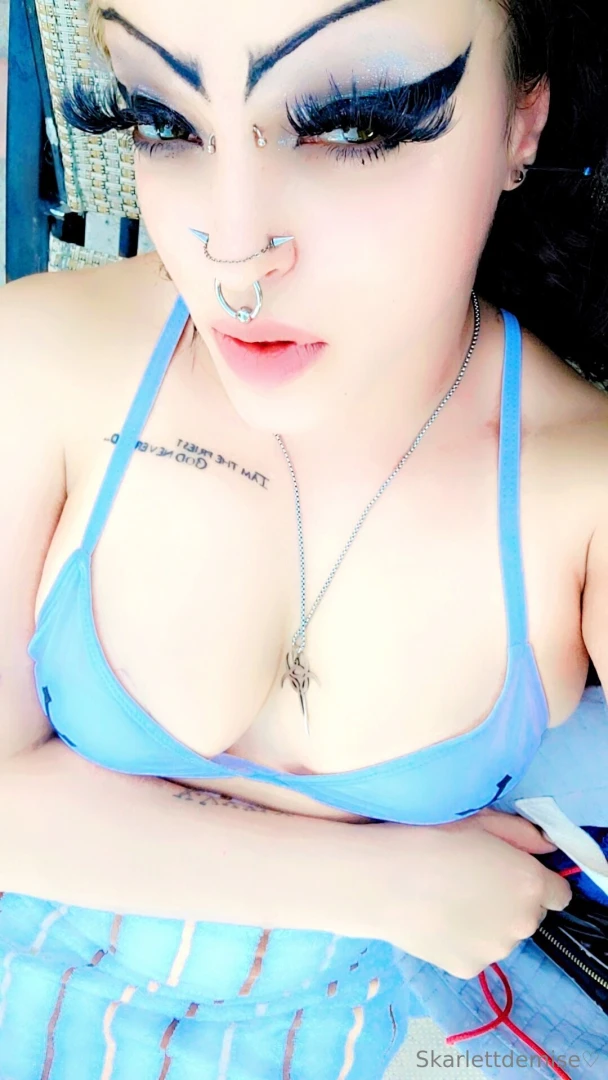 Surgery is this week leave a tip to show your support part 1 