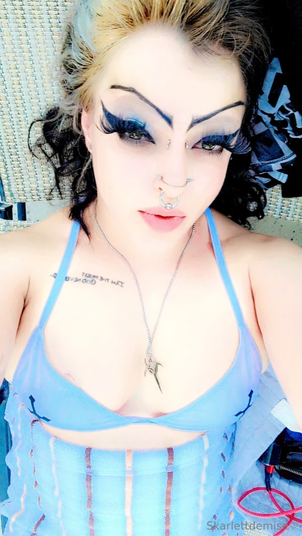 Surgery is this week leave a tip to show your support 