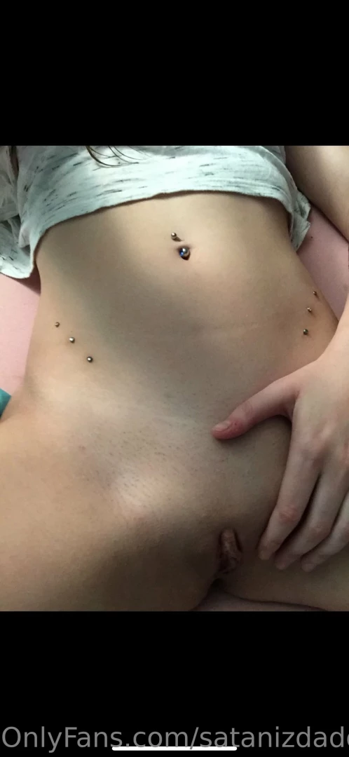 I miss my dermals should i get them done again my kitty always shaved 