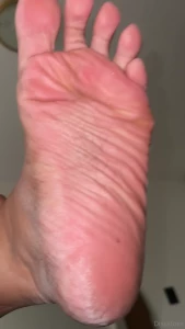 Omg i ve been walking all over mexico city with sandals and look how part 1