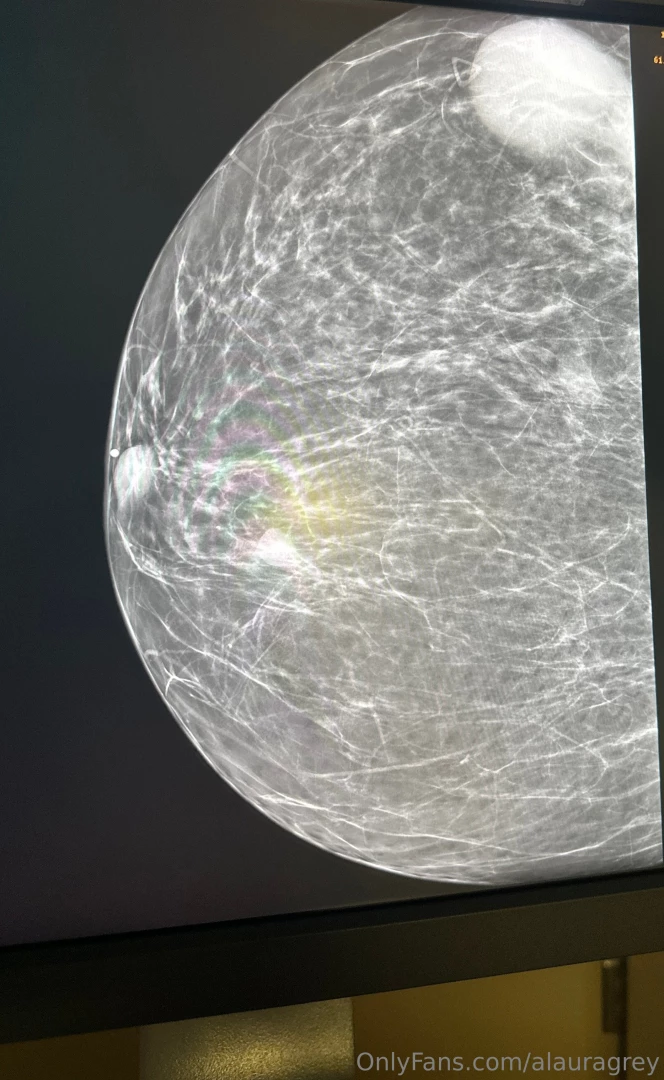 For those curious and wondering about my appointment my tumor grew so 