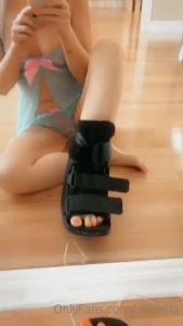 I tripped and fell and now my foot is killing me anyone wanna take