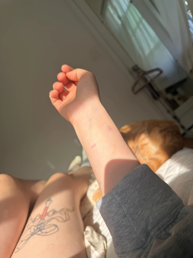 Hurt my left big toe and got bit by a dog at work today 