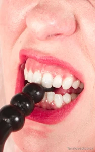 My vampire teeth