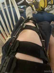 Any suggestions on content i can make while having a broken knee part 1