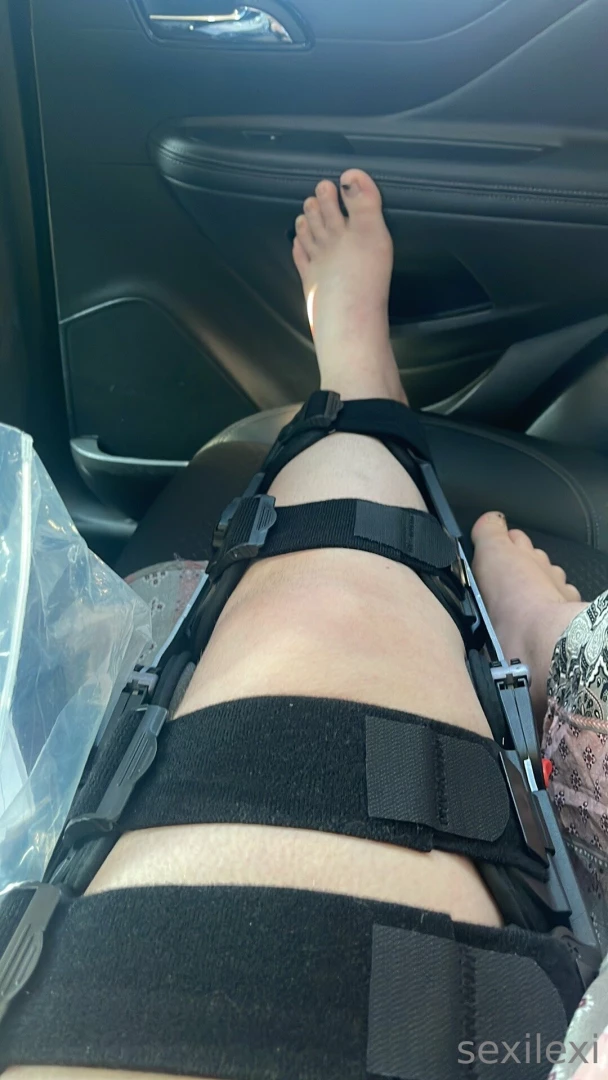 Any suggestions on content i can make while having a broken knee part 4 