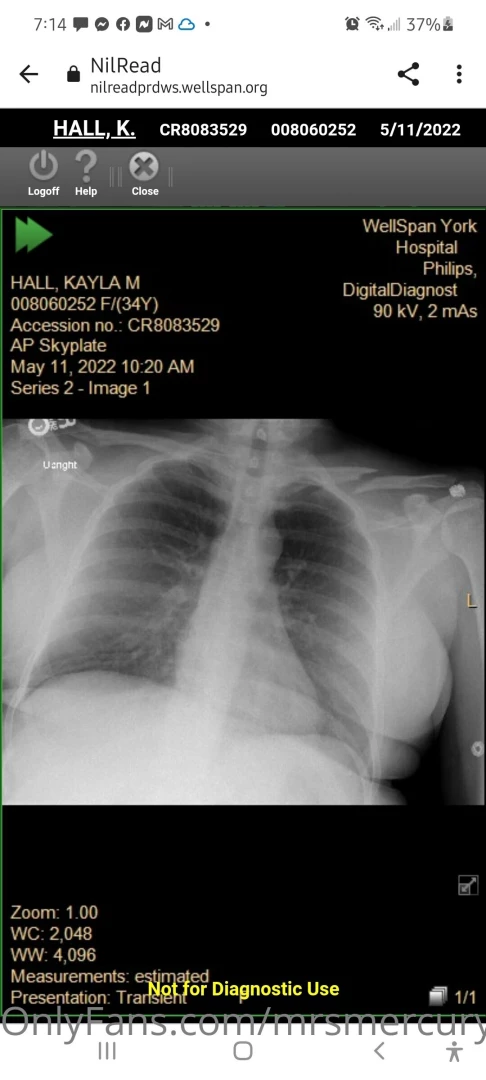 Hey ya ll i was in a car accident on my way home work the other 