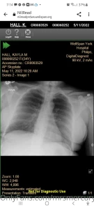 Hey ya ll i was in a car accident on my way home work the other