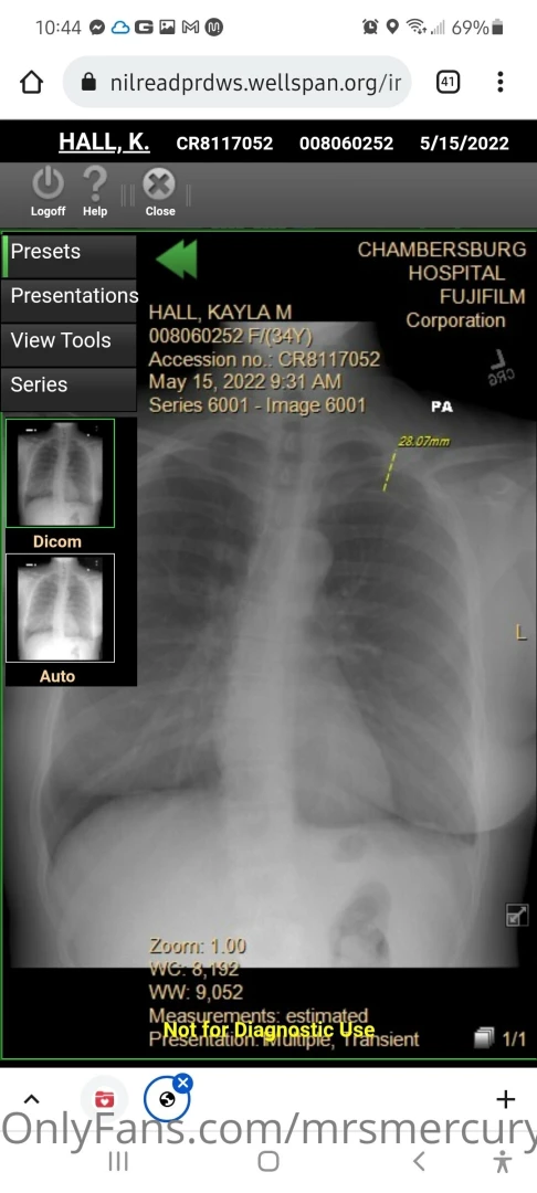 Hey ya ll i was in a car accident on my way home work the other part 4 