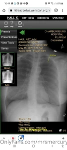 Hey ya ll i was in a car accident on my way home work the other part 4