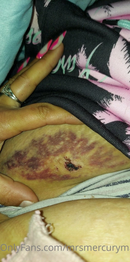 Hey ya ll i was in a car accident on my way home work the other part 1 