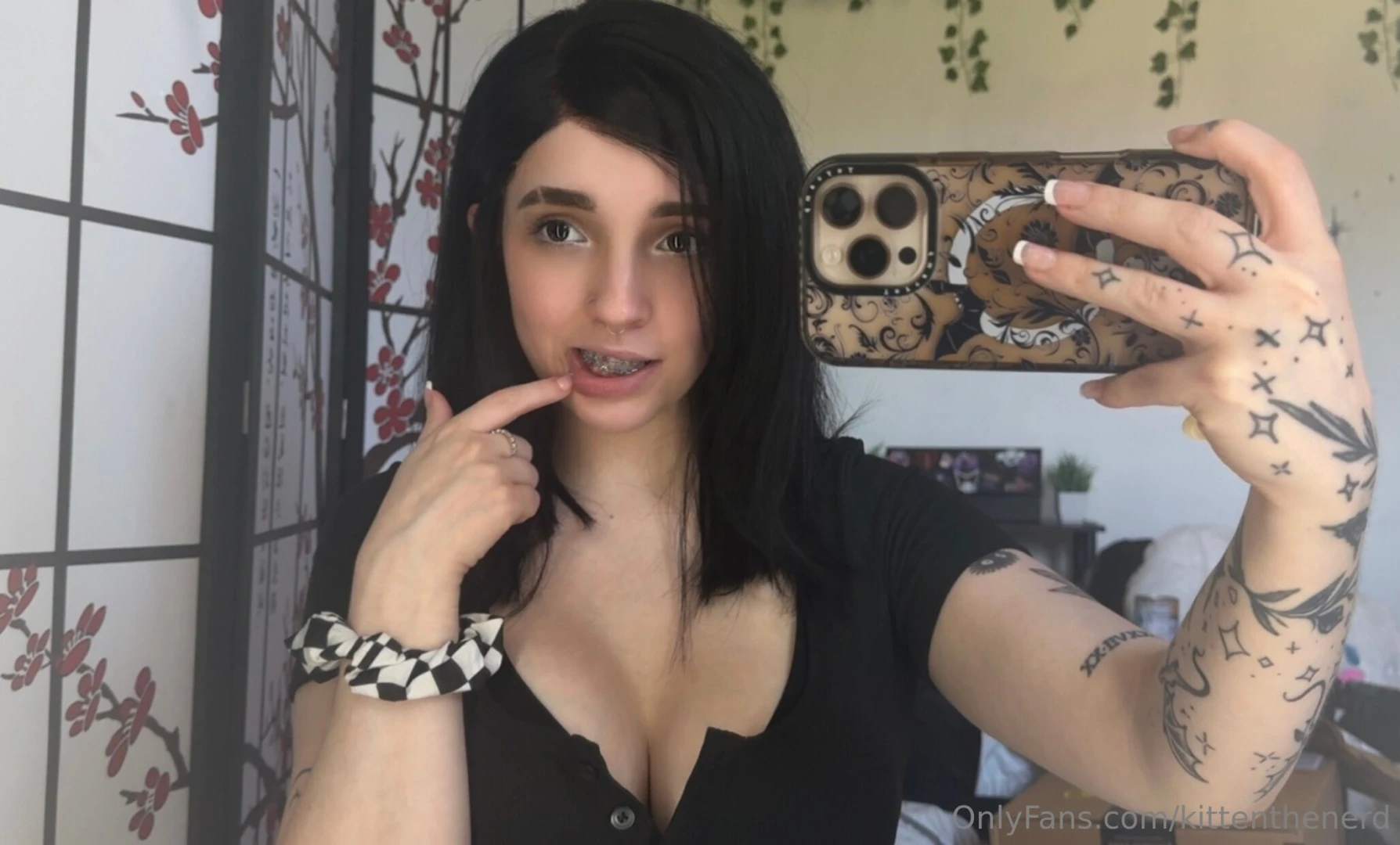 Not a wedgie but i did get braces today y or n part 1 